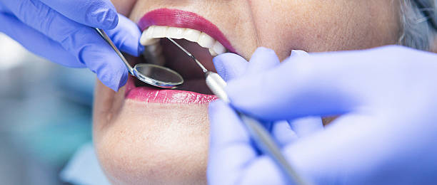 Best Broken or Chipped Tooth Repair in Duncan Falls, OH
