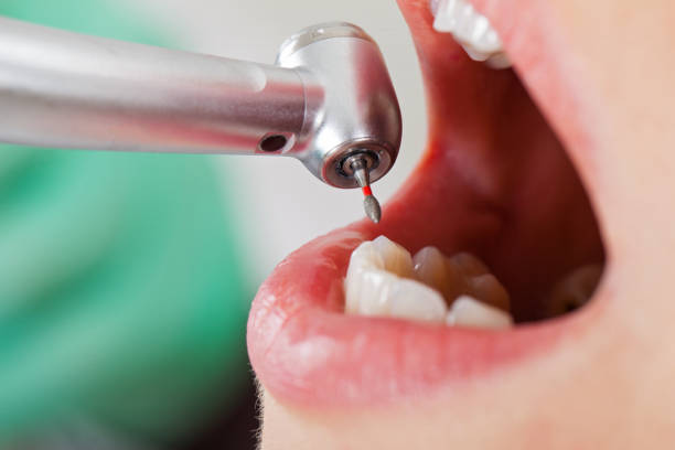 Best Weekend Emergency Dental Services in Duncan Falls, OH